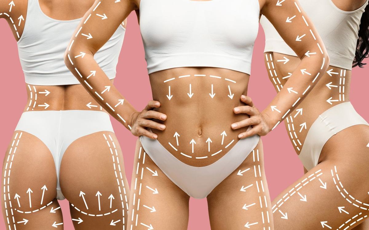 3D-Bodyscan mit Bodygee bei Privomed Bodyline
