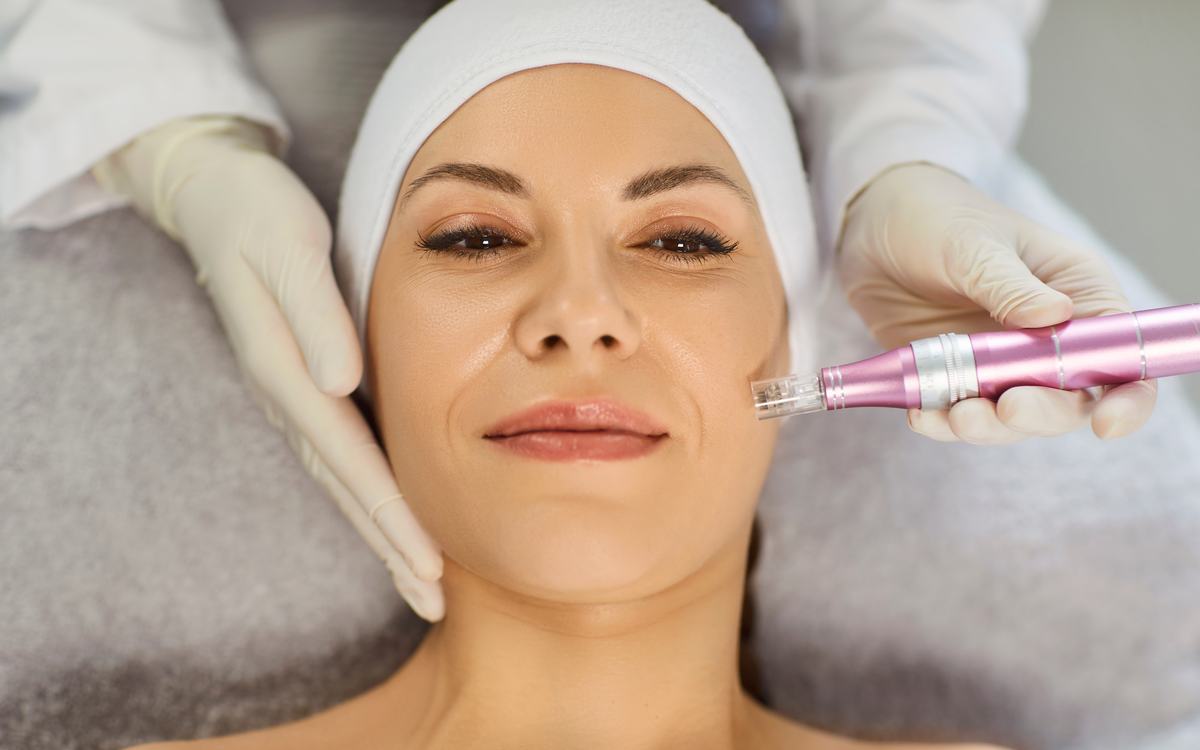 Microneedling bei Privomed Bodyline